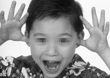 多动少年“变形记”