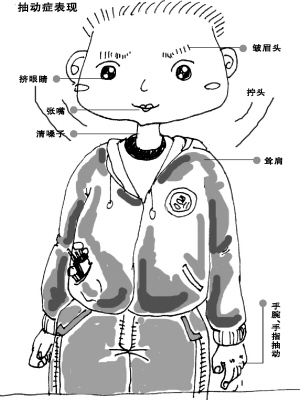如何检查儿童抽动症
