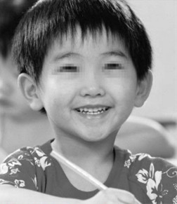 家长咨询：孩子的表现是不是多动症？