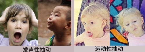 抽动症儿童会有哪些具体表现